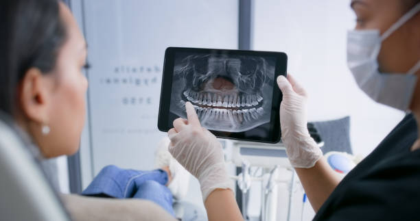 Licensed Tooth Extraction service in West Menlo Park, CA - Smile Center Dentistry